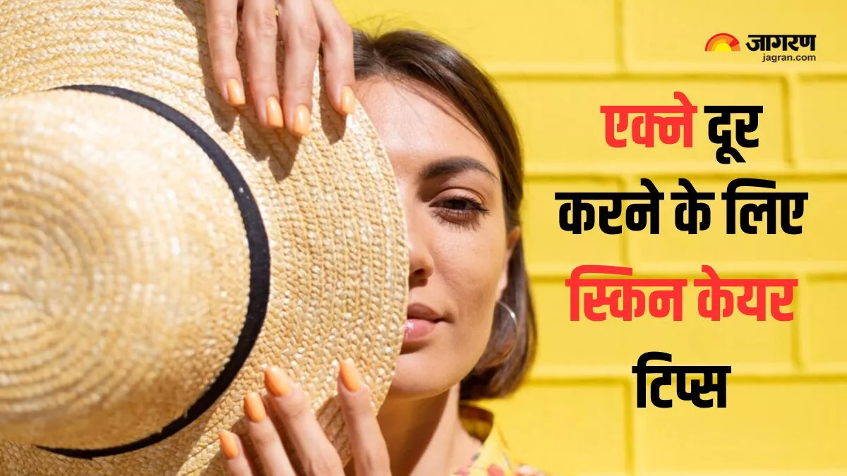 Acne Skincare: क्या आप भी गर्मियों में रहते हैं एक्ने से परेशान, तो इन स्किन केयर टिप्स से करें इनका समाधान