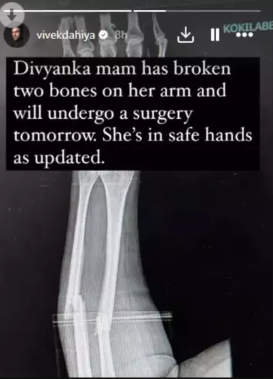 divyanka tripathi in hospital 