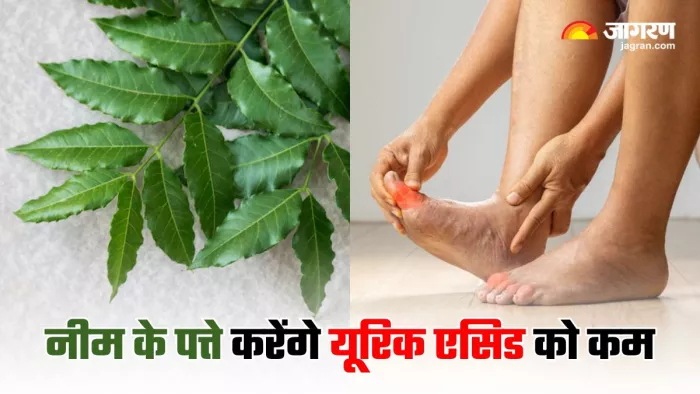High Uric Acid से परेशान लोग इन 5 तरीकों से करें नीम के पत्तों का इस्तेमाल (Image Source: Freepik)