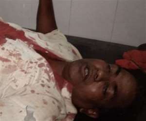 Hazaribagh News: हजारीबाग के नावाटांड़ में अपराधियों ने मुखिया प्रत्याशी को गोली मारी...चुनाव प्रचार कर लाैट रहे थे घर