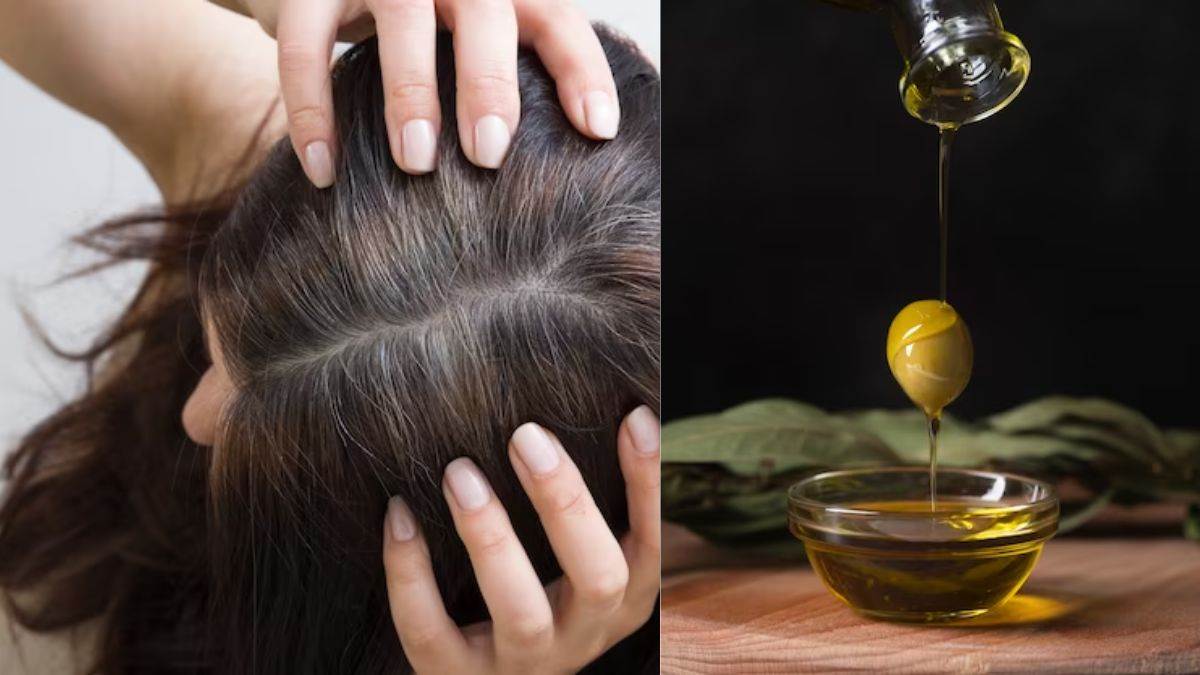 https://www.jagranimages.com/images/newimg/19052023/19_05_2023-home_remedies_for_lice_23416895.jpg