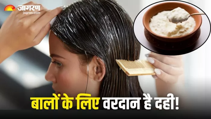 दही में छिपा है बालों की कई समस्याओं का इलाज, बस ऐसे करें इस्तेमाल (Image Source: Freepik)