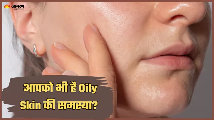 ऑयली स्किन की समस्या है तो ध्यान रखें ये बातें। (Image Credit- Freepik)