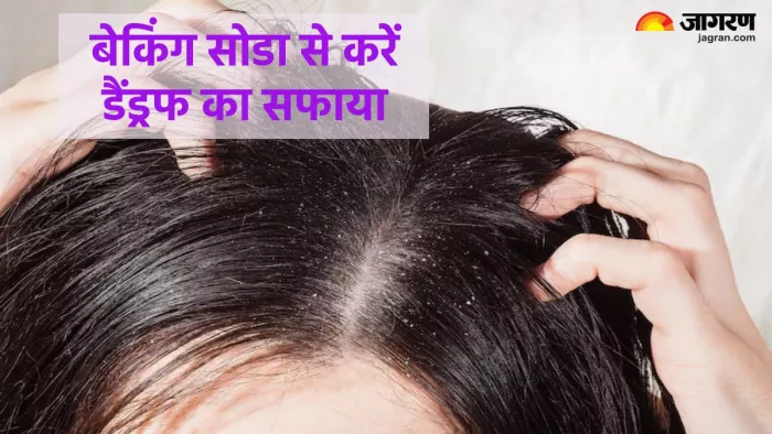डैंड्रफ दूर करने में बेकिंग सोडा है फायदेमंद (Pic credit- freepik)