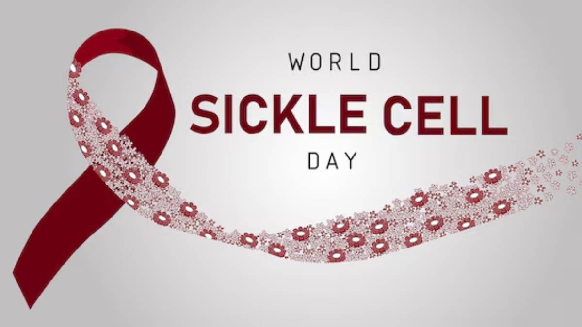 world sickle cell day 2024 common signs and symptoms of sickle cell disease