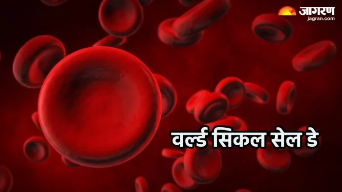 विश्व सिकल सेल दिवस इतिहास व महत्व (Pic credit- freepik)