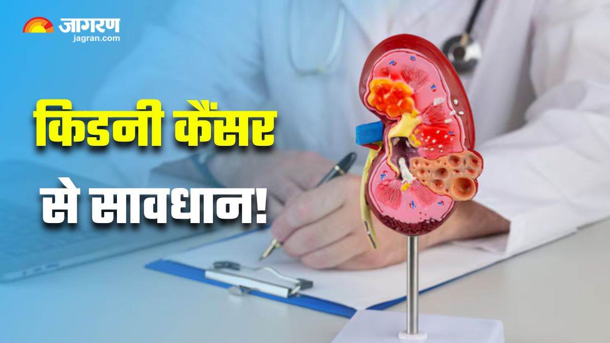https://www.jagranimages.com/images/newimg/19062025/19_06_2025-kidney_cancer_symptoms_23967918.jpg