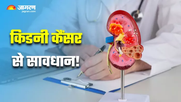 World Kidney Cancer Day 2025: डॉक्टर ने बताए किडनी कैंसर के साइलेंट साइन (Image Source: Freepik)