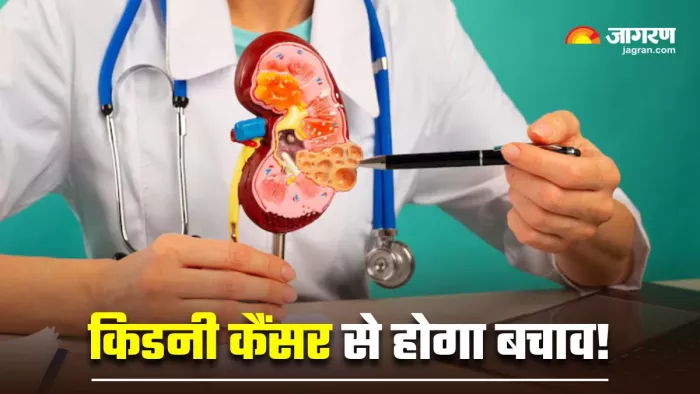World Kidney Cancer Day 2025: इन 7 तरीकों से रखें किडनी को हेल्दी (Image Source: Freepik)