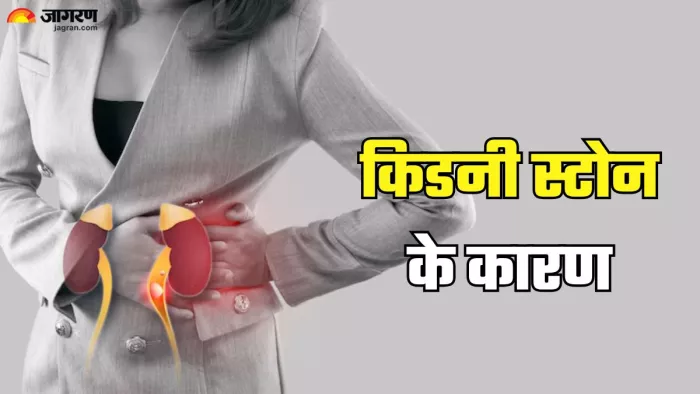 किडनी स्टोन से बचने के लिए अपनाएं ये डाइट और लाइफस्टाइल टिप्स (Picture Credit- Freepik)