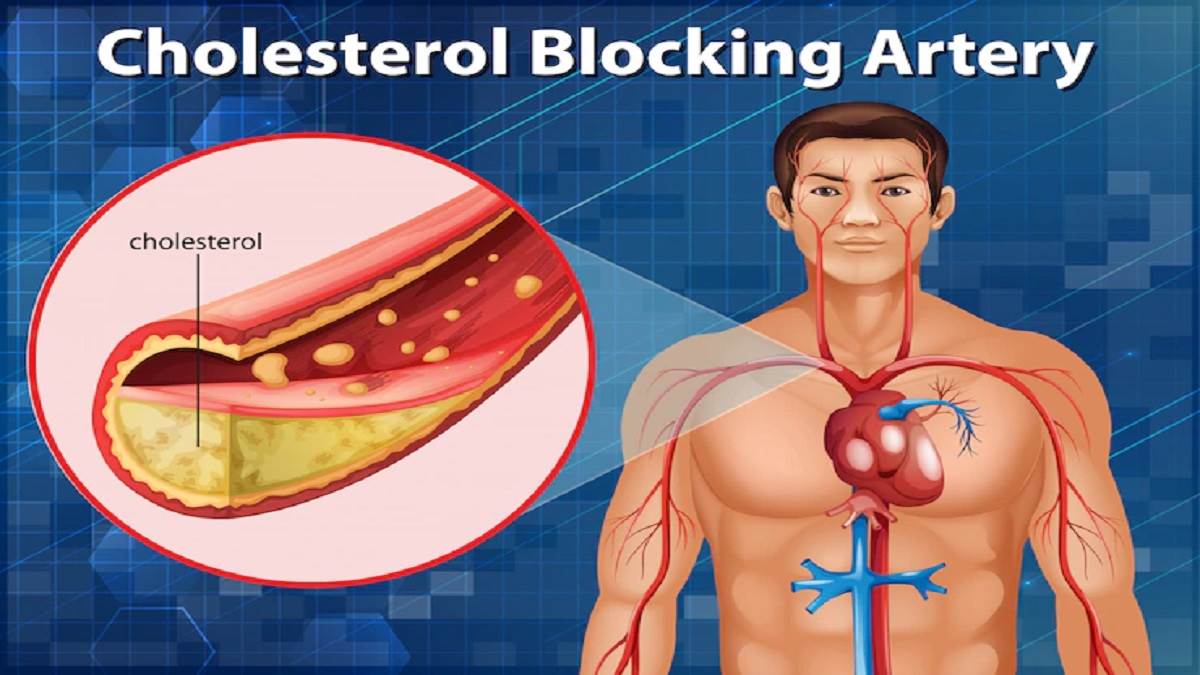 Cholesterol: नेचुरल तरीके से बढ़ते कोलेस्ट्रॉल को कंट्रोल करने के लिए फॉलो करें ये टिप्स