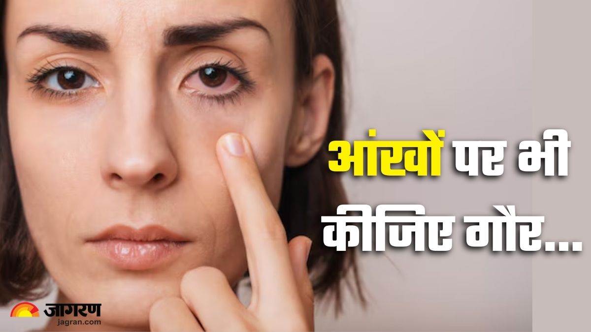 https://www.jagranimages.com/images/newimg/19082025/19_08_2025-eye_symptoms_of_disease_24017686.jpg