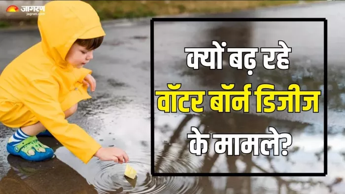 वाराणसी में वाटरबर्न डिजीज का खतरा बढ़ गया है।