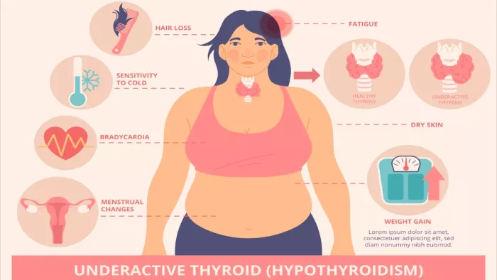 Hypothyroidism Diet: हाइपोथायराइडिज्म में न करें इन चीज़ों का सेवन