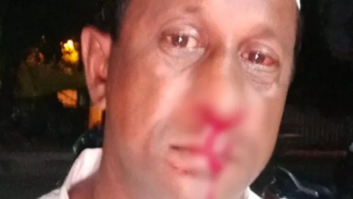 जमशेदपुर में पत्रकार अनवर शरीफ पर जानलेवा हमला।