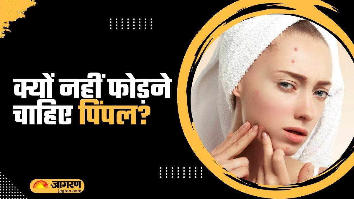 https://www.jagranimages.com/images/newimg/19092024/19_09_2024-why_should_you_never_pop_pimples_23799921.jpg