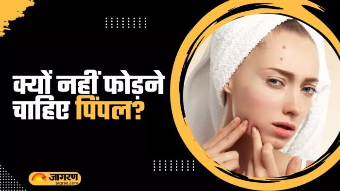 क्यों पिंपल फोड़ना पड़ सकता है भारी? (Picture Courtesy: Freepik)