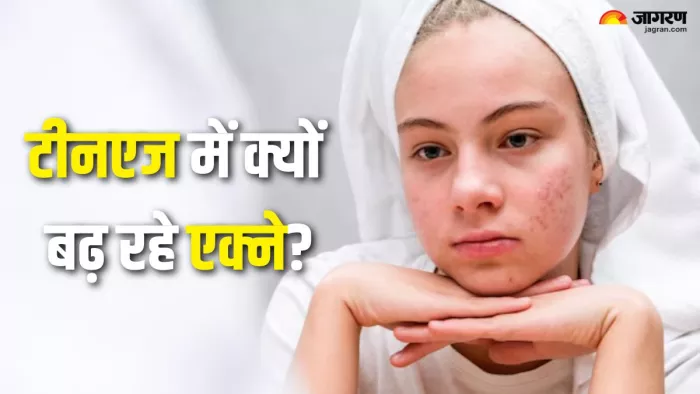 टीनएजर्स में क्यों बढ़ रहे एक्ने के मामले (Picture Credit- Freepik)