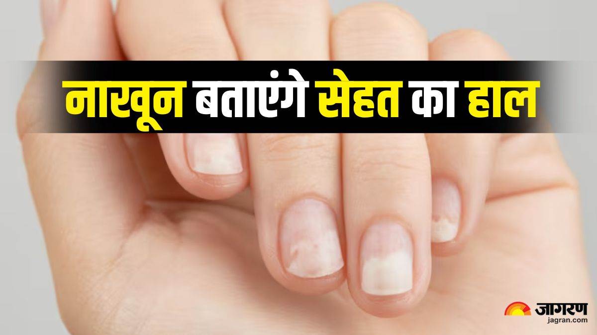 what your nails say about your health a guide to key signs