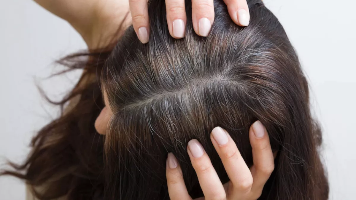 Premature Grey Hair Treatment: समय से पहले सफेद हो रहे बालों की समस्या दूर  करेंगे ये नेचुरल उपाय - Premature Grey Hair Treatment effective home  remedies to get rid of grey hair