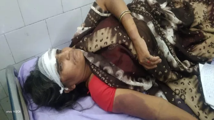 मुफस्सिल क्षेत्र के अलगुंदा गांव में पति की मारपीट से गंभीर हुई आशा देवी सदर अस्पताल में इलाजरत।