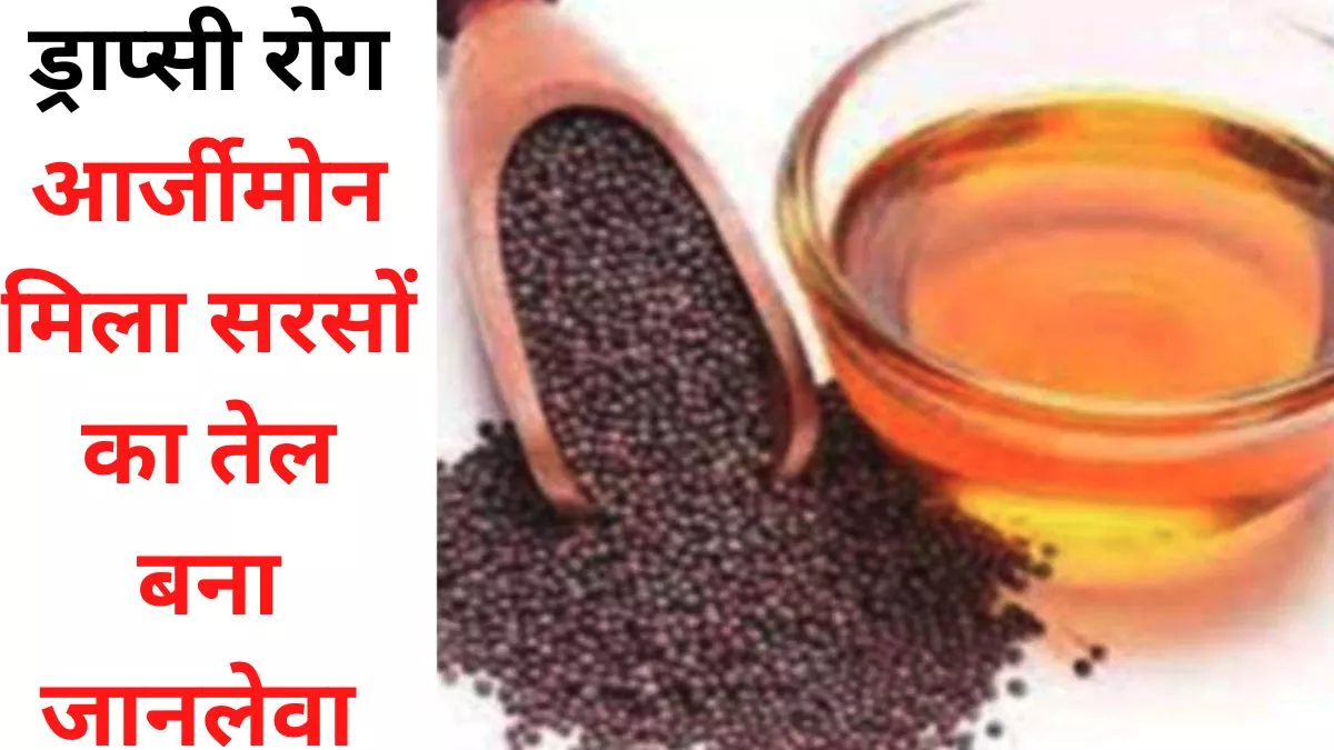 Himachal Pradesh: आर्जीमोन मिला सरसों का तेल बना जानलेवा, ये 4 लक्षण हैं ड्राप्‍सी रोग के संकेत