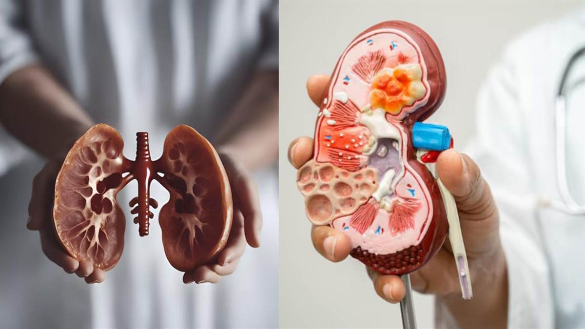 https://www.jagranimages.com/images/newimg/20032025/20_03_2025-kidney_23902988.jpg