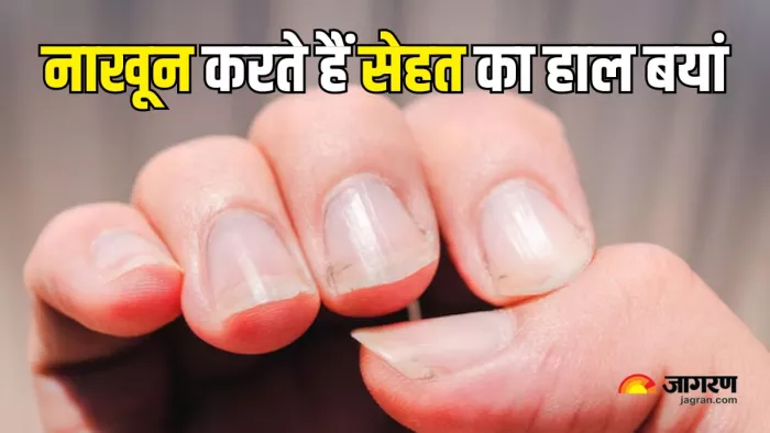 Nail Warning Signs: नाखूनों से लगाएं पोषण की कमी का पता (Picture Courtesy: Freepik)