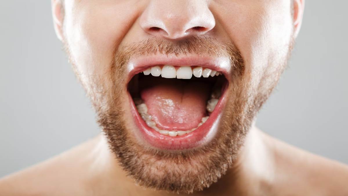 https://www.jagranimages.com/images/newimg/20042023/20_04_2023-dry_mouth_remedies_f_23389784.jpg