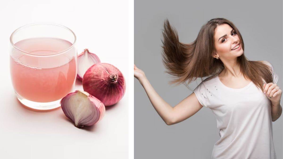 Do You Know Onion is a Miraculous Remedy for Hair Growth