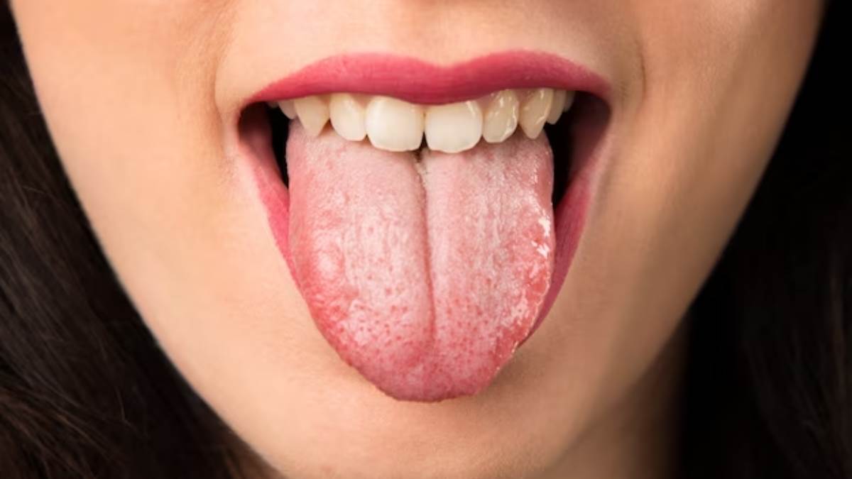 https://www.jagranimages.com/images/newimg/20042024/20_04_2024-tongue_clean_23700538.jpg
