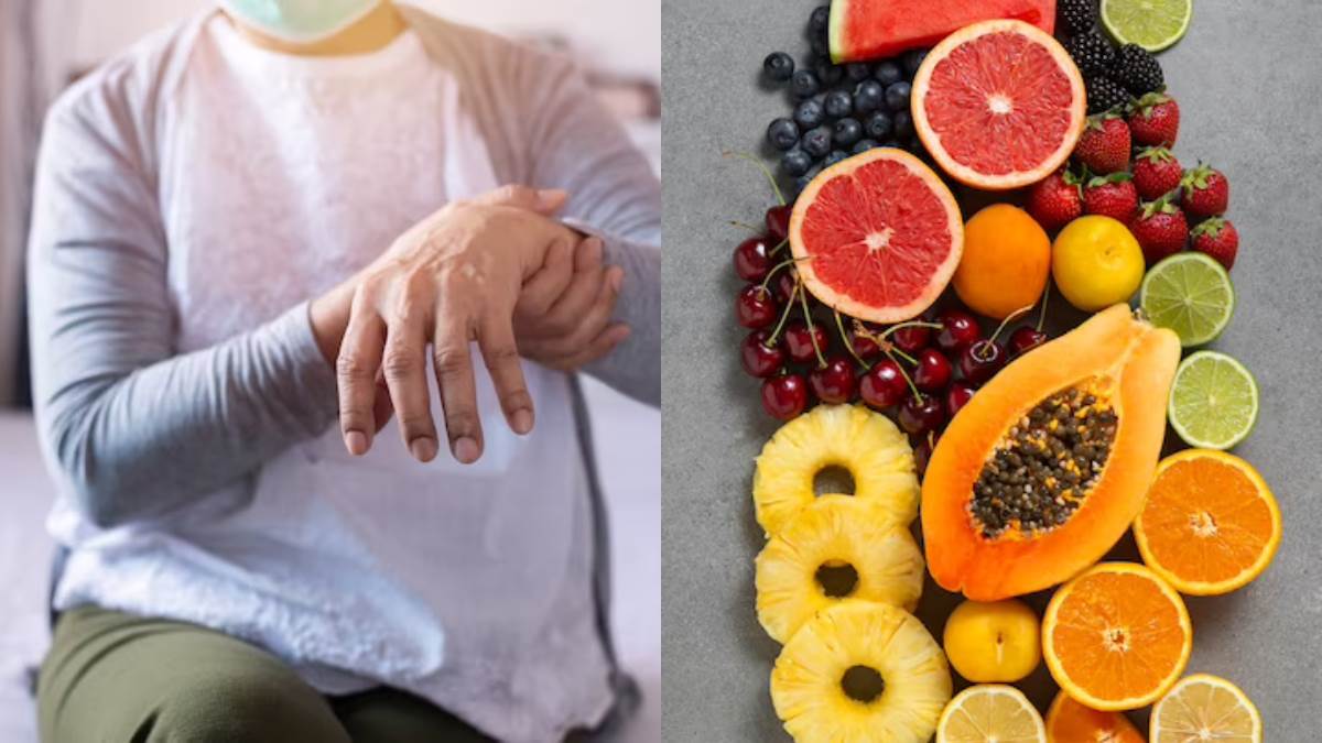 Fruits For Arthritis गठिया के मरीजों के लिए फायदेमंद हो सकते हैं ये 5 फल, जोड़ों के दर्द में