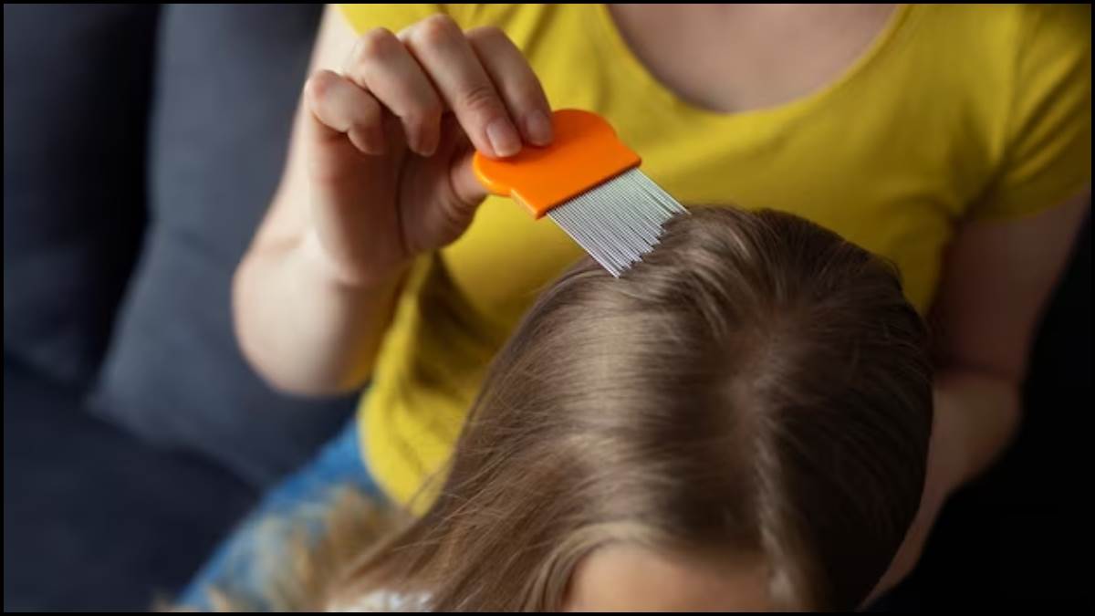 what causes lice in summer know some home remedies to get rid of hair lice
