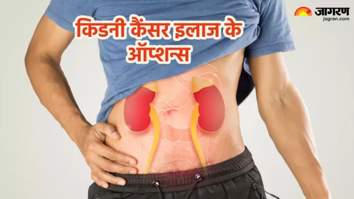 किडनी कैंसर ट्रीटमेंट के ऑप्शन्स (Pic credit- freepik)