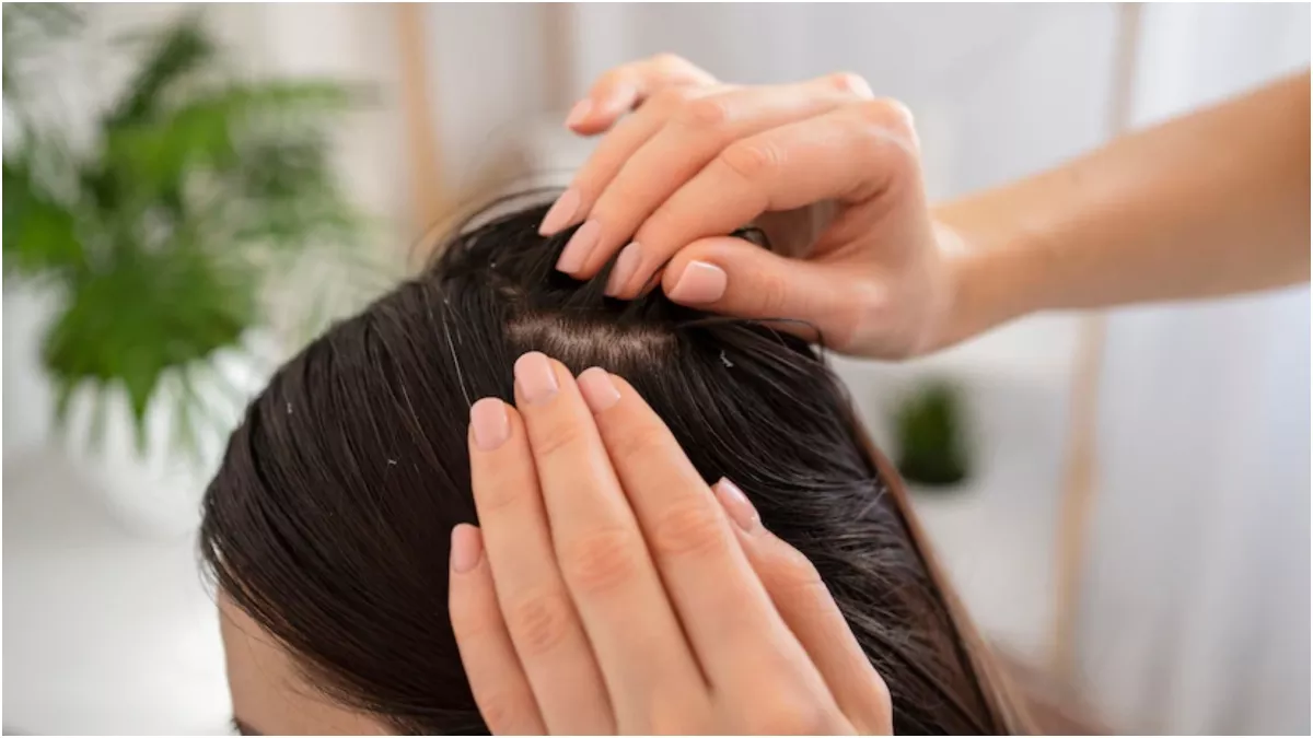 How To Remove Dandruff: बहुत हो गई है डैंड्रफ की समस्या? इन आयुर्वेदिक ट्रीटमेंट से होगा समाधान