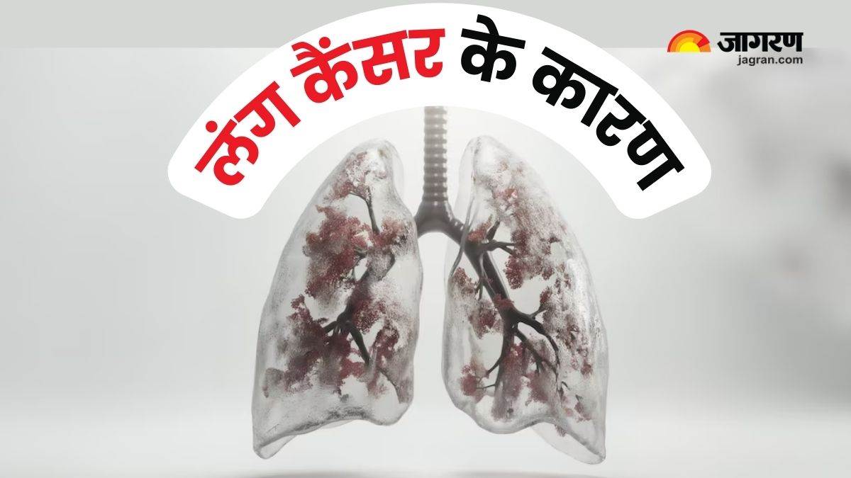 https://www.jagranimages.com/images/newimg/20072024/20_07_2024-lung_cancer__23762080.jpg