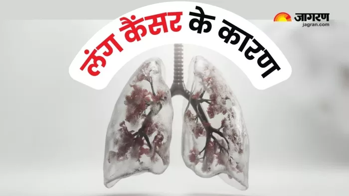 नॉन-स्मोकर्स में Lung Cancer की वजहें (Picture Courtesy: Freepik)