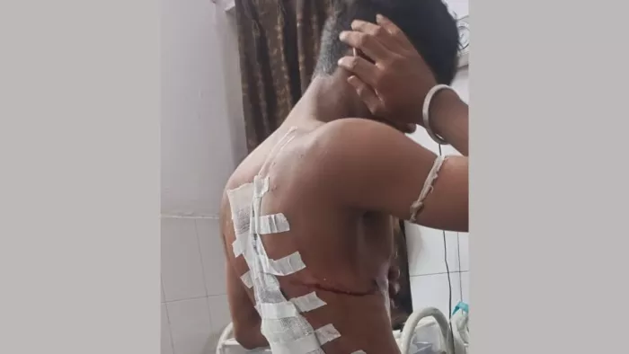 स्वजन लगा रहे गोली मारने का आरोप, पुलिस चाकू से बता रही हमला
