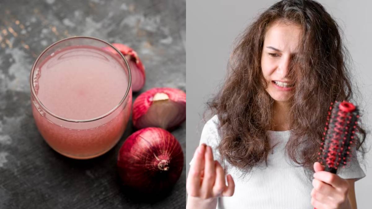 Onion Juice Side Effects क्या बालों के लिए नुकसानदायक है प्याज का रस