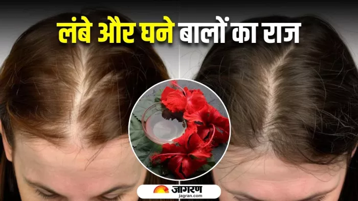 बालों के लिए ऐसे तैयार करें गुड़हल का तेल (Image Source: Freepik)
