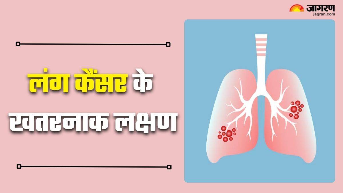 https://www.jagranimages.com/images/newimg/20082025/20_08_2025-lung_cancer_signs_24019082.jpg