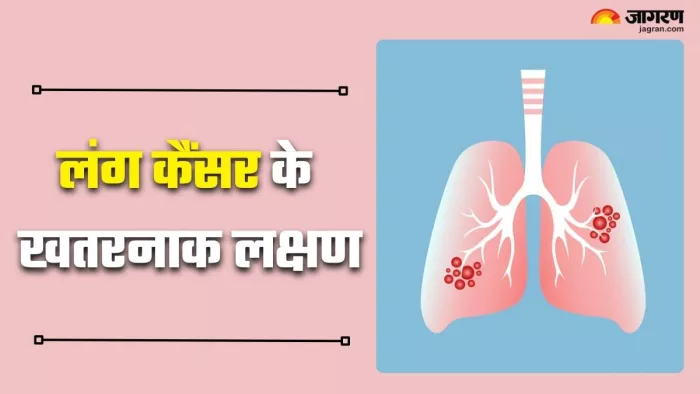 फेफड़ों के कैंसर के लक्षण रात में दिखने वाले इन संकेतों पर दें ध्यान! (Picture Credit- Freepik)