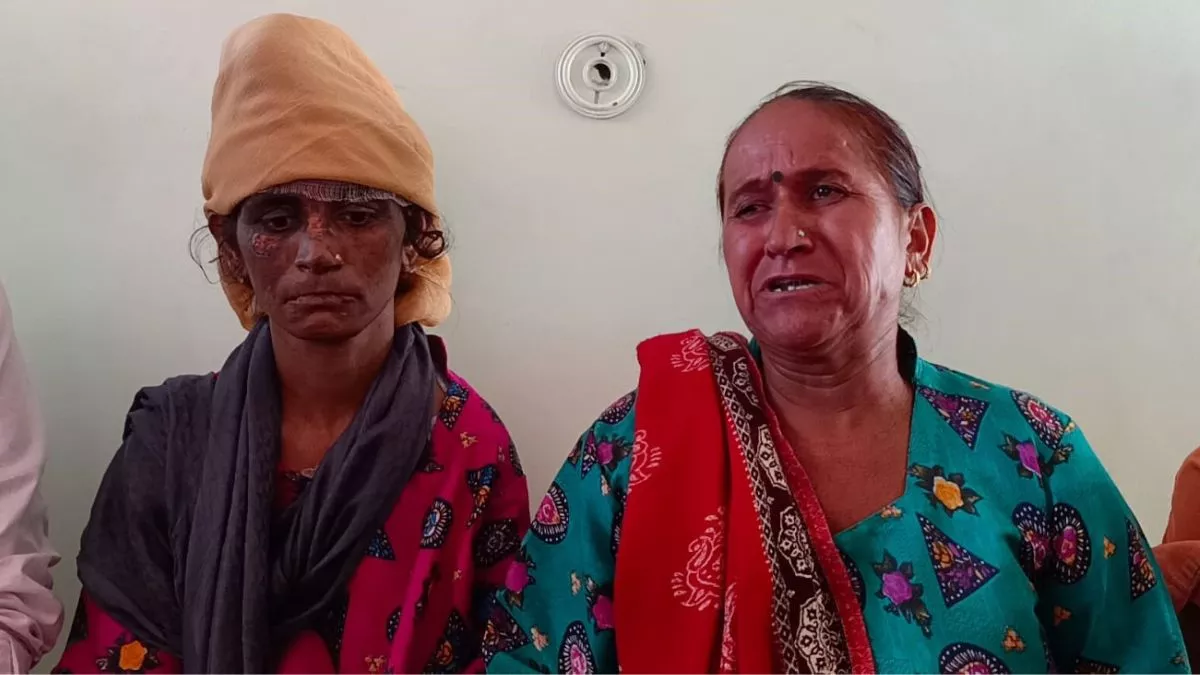 Uttarakhand Crime News: विवाहिता प्रीति के पूरे शरीर पर थे जलाने और चोट के निशान, मेडिकल टीम भी सन्न