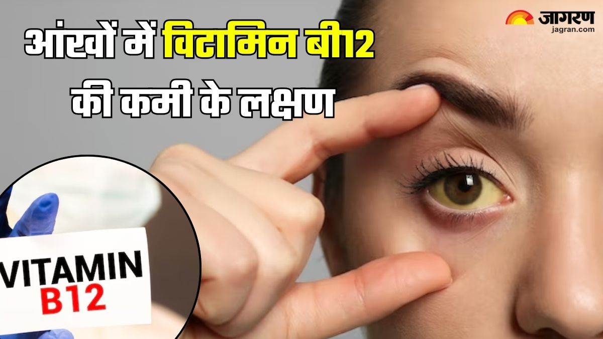 how vitamin b12 deficiency affect your eyes know top 5 sypmtoms here vitamin b12 ki kami ke lakshan