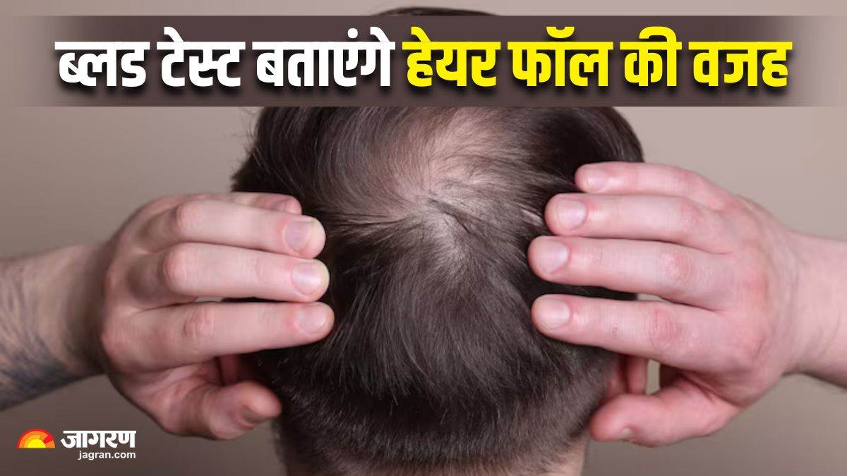 https://www.jagranimages.com/images/newimg/20092025/20_09_2025-blood_tests_for_hair_loss_24053639.jpg