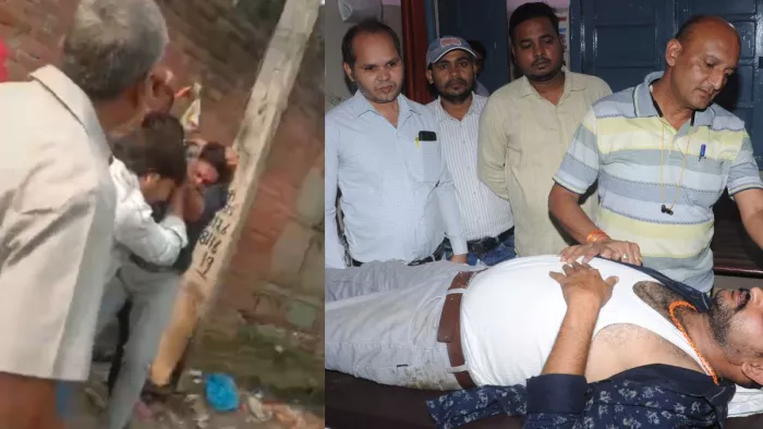 Shamli News: बकाया भुगतान के लिए पहुंची टीम को पीटा गया, घायल जेई।