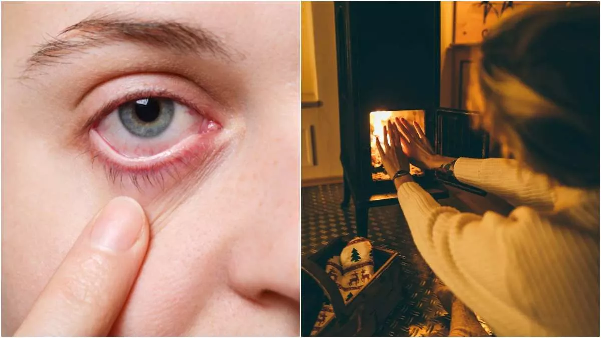 Heater Affects Eyes आपकी आंखों को गंभीर नुकसान पहुंचा सकता है रूम हीटर