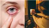 Heater Affects Eyes: हीटर का ज़्यादा इस्तेमाल पहुंचाता है आंखों को नुकसान