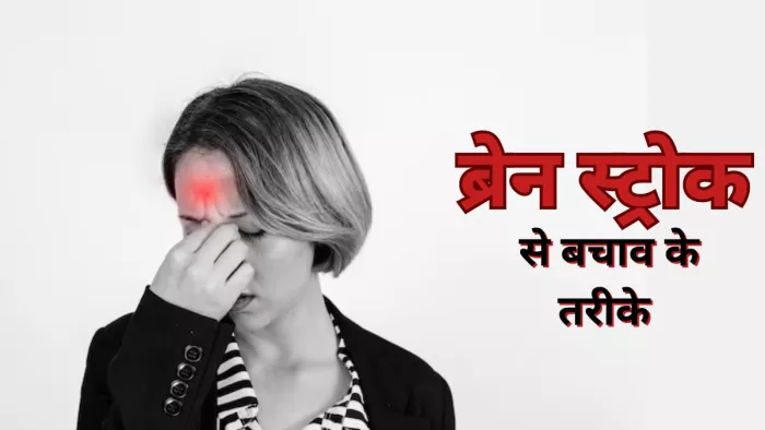ब्रेन स्ट्रोक से बचाव में मददगार होंगे ये टिप्स