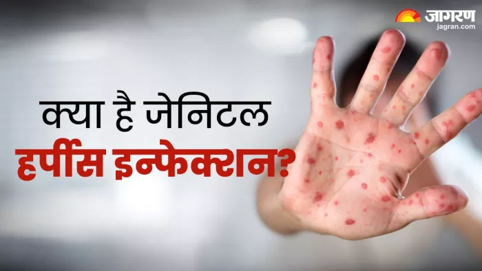 क्या है जेनिटल हर्पीस इन्फेक्शन, इसके कारण, लक्षण व उपचार